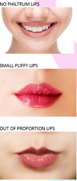 Diagonal Lips Common shapes of lips - Enhance Me Training Academy