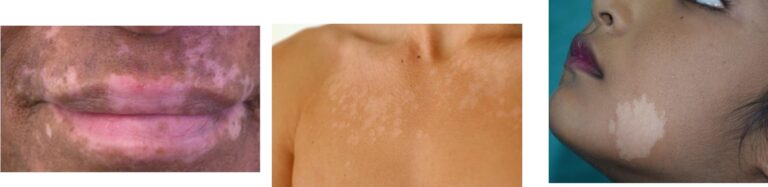 Skin colourings & Ethnicity - Enhance Me Training Academy